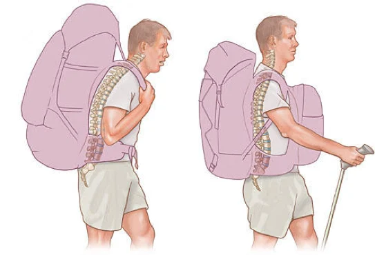 Two hikers compared: a heavy, poorly fitted pack pulling the spine backwards versus a well-fitted pack and walking pole