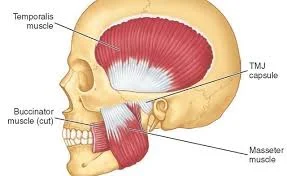 Diagram of the side of the skull showing the jaw muscles: temporalis, masseter, buccinator and the TMJ capsule