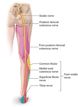 Diagram of the back of the leg showing the path of the sciatic nerve and the skin areas its branches supply