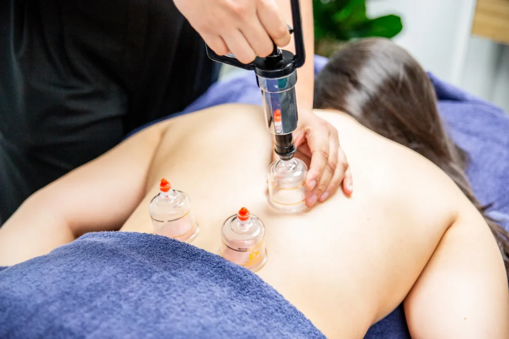 Cupping during a remedial massage
